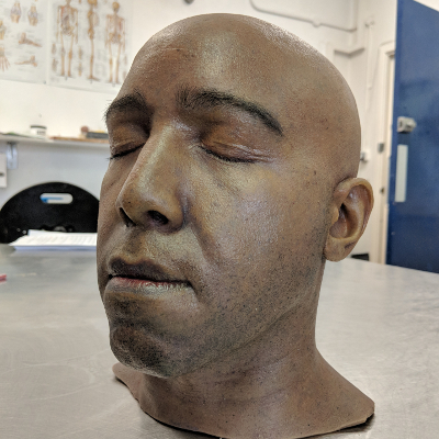 Holby City Patient Head